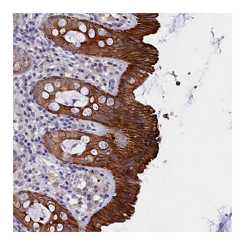 Atlas Antibodies Anti-C16orf62 Antibody