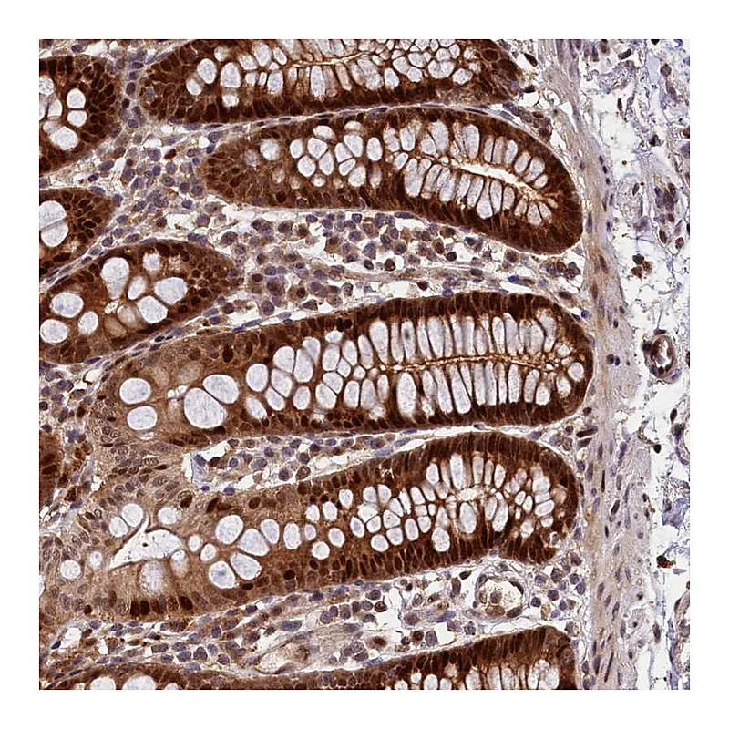 Atlas Antibodies Anti-C16orf70 Antibody