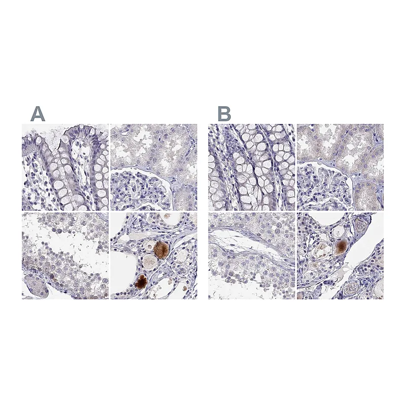 Atlas Antibodies Anti-C16orf89 Antibody