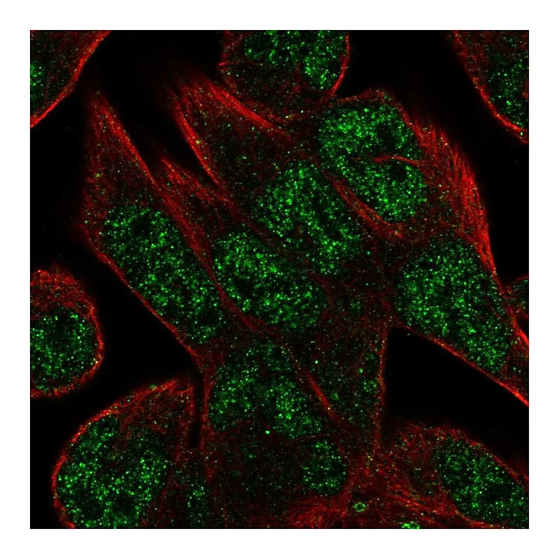 Atlas Antibodies Anti-C16orf72 Antibody