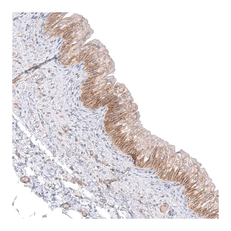 Atlas Antibodies Anti-C16orf74 Antibody