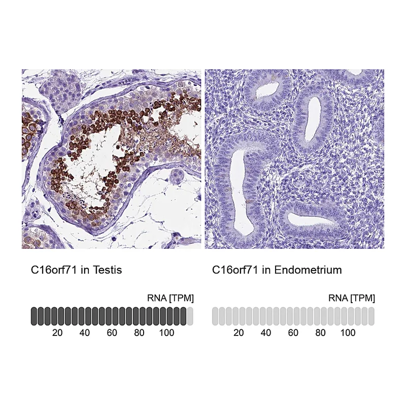 Atlas Antibodies Anti-C16orf71 Antibody