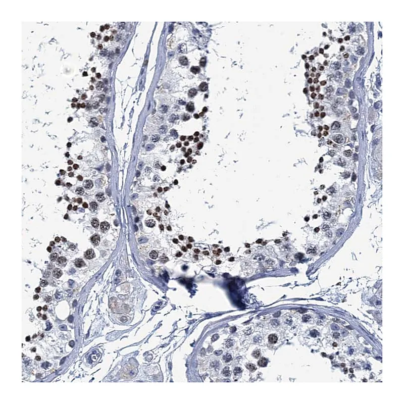 Atlas Antibodies Anti-C16orf95 Antibody