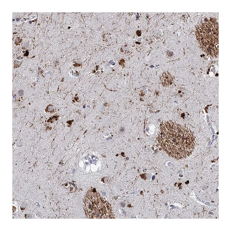 Atlas Antibodies Anti-C16orf72 Antibody