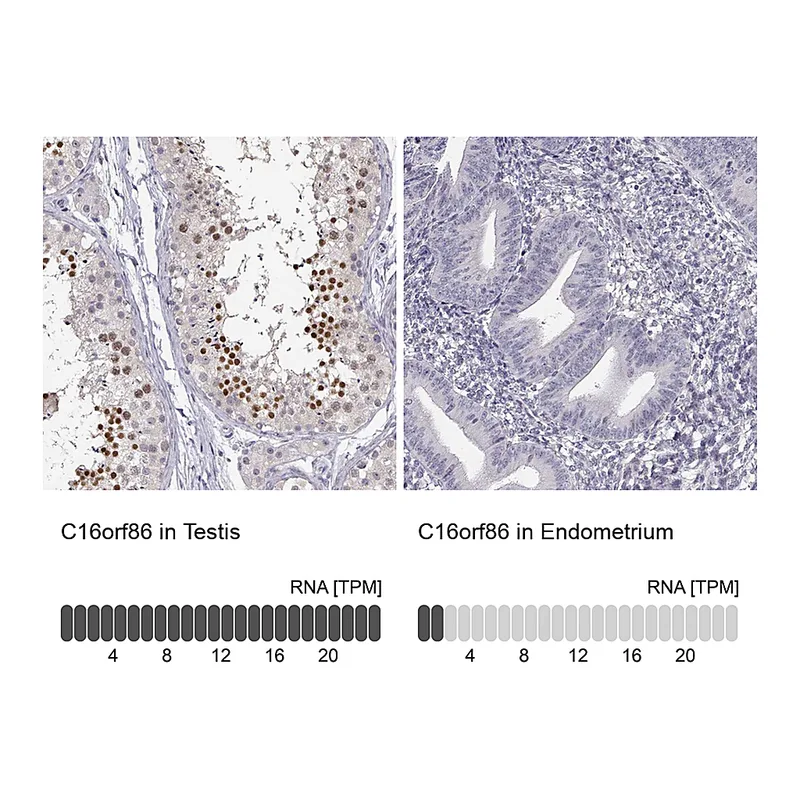 Atlas Antibodies Anti-C16orf86 Antibody