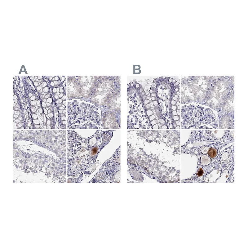 Atlas Antibodies Anti-C16orf89 Antibody