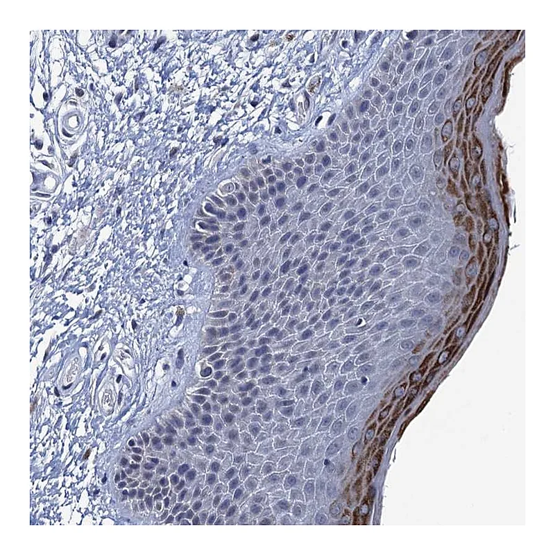 Atlas Antibodies Anti-C16orf87 Antibody