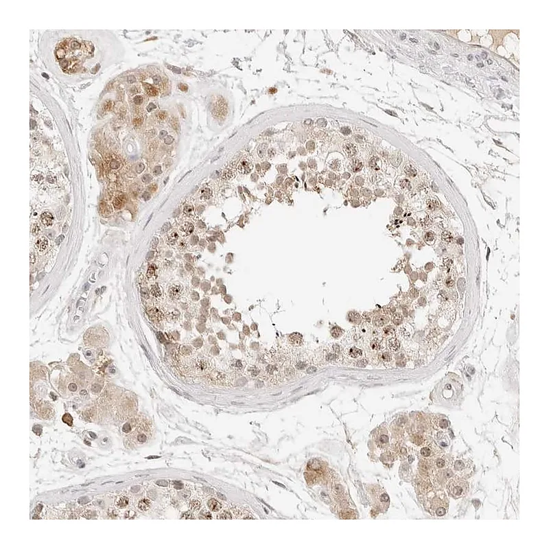 Atlas Antibodies Anti-C17orf47 Antibody