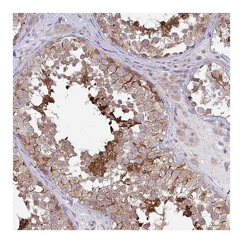 Atlas Antibodies Anti-C17orf105 Antibody