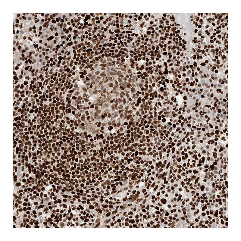 Atlas Antibodies Anti-C17ORF49 Antibody