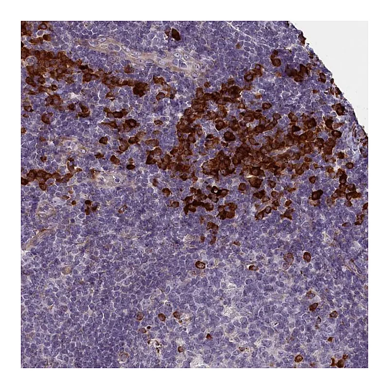Atlas Antibodies Anti-C16orf96 Antibody