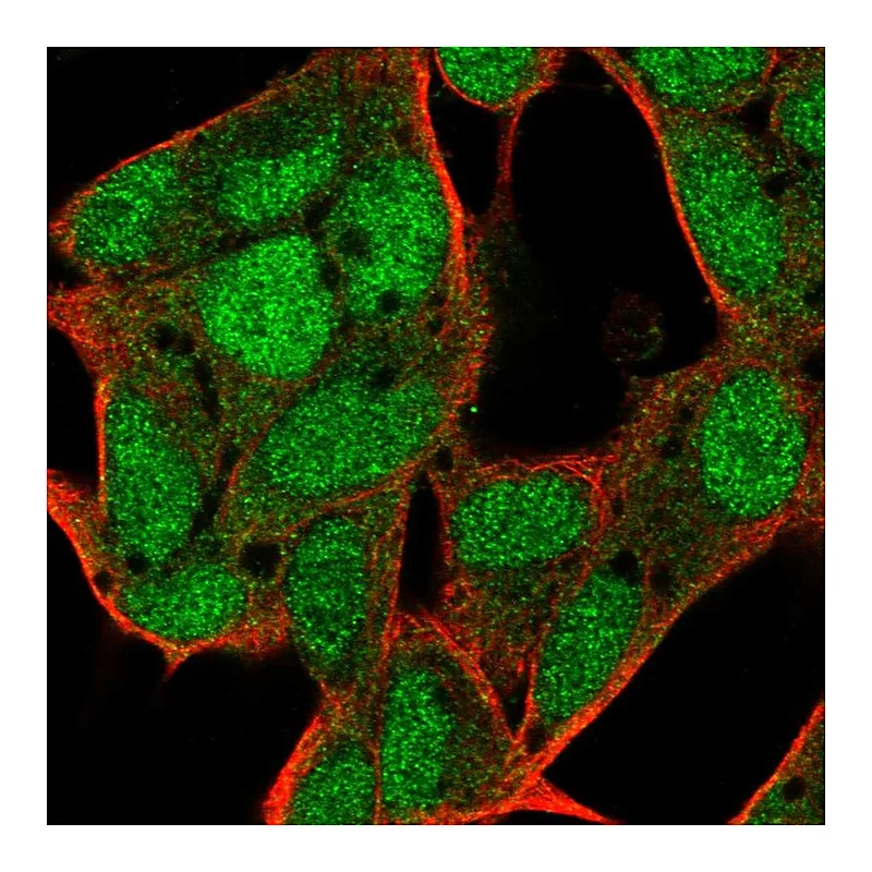 Atlas Antibodies Anti-C17orf100 Antibody