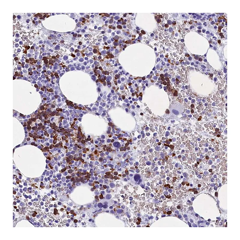 Atlas Antibodies Anti-C16orf96 Antibody