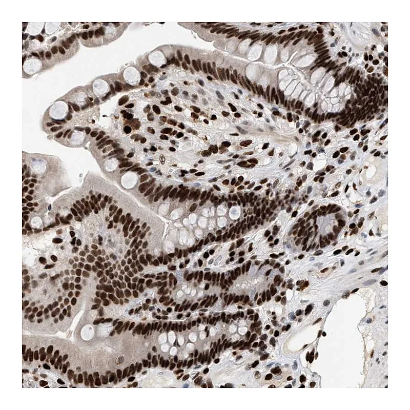 Atlas Antibodies Anti-C17orf49 Antibody