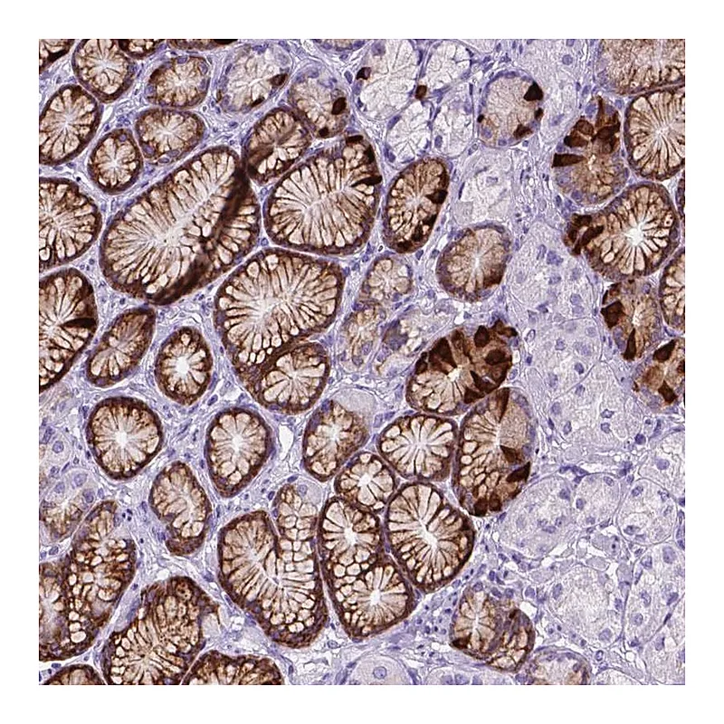 Atlas Antibodies Anti-C17orf107 Antibody