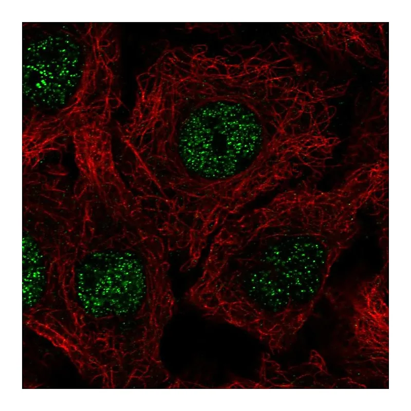 Atlas Antibodies Anti-C17orf50 Antibody