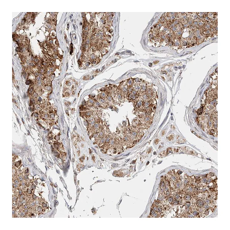 Atlas Antibodies Anti-C17orf53 Antibody