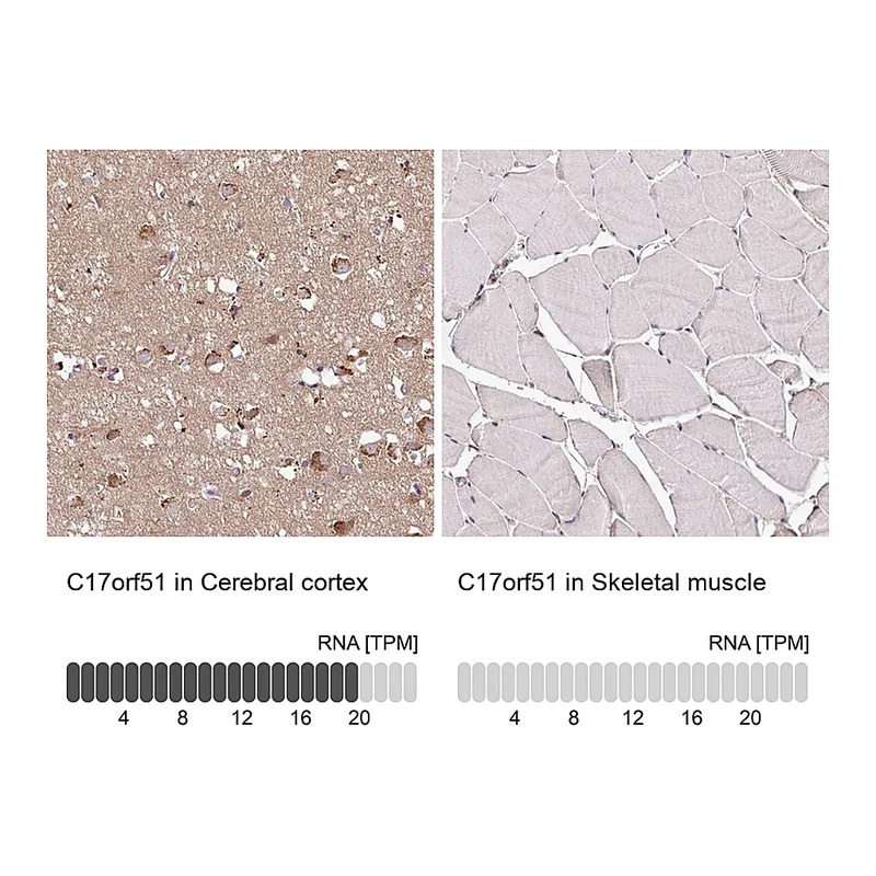Atlas Antibodies Anti-C17orf51 Antibody