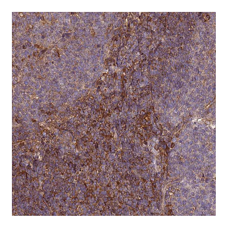 Atlas Antibodies Anti-C17orf62 Antibody