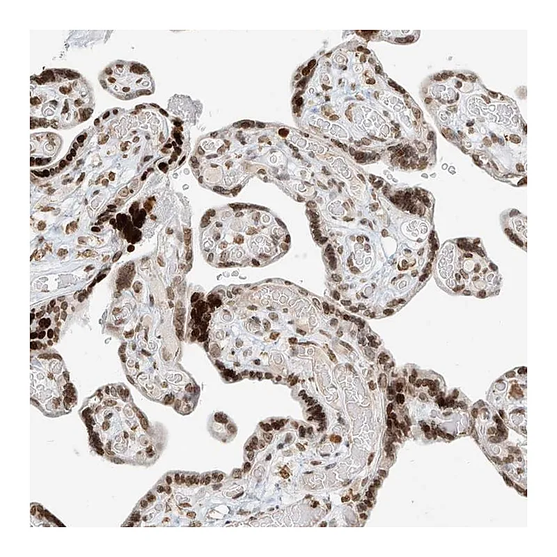 Atlas Antibodies Anti-C17orf58 Antibody