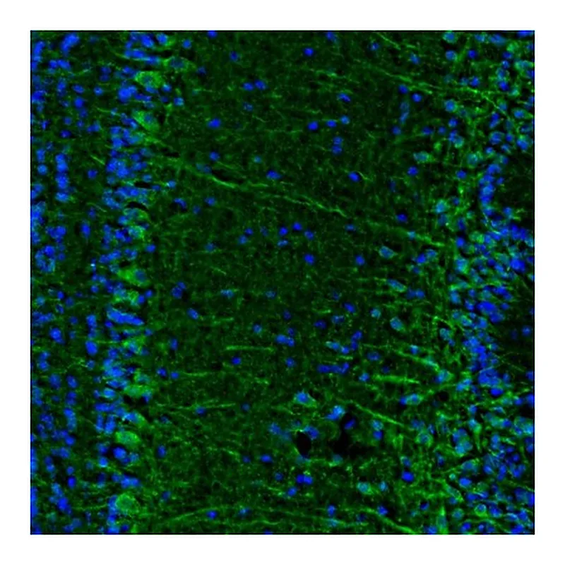 Atlas Antibodies Anti-C17orf75 Antibody