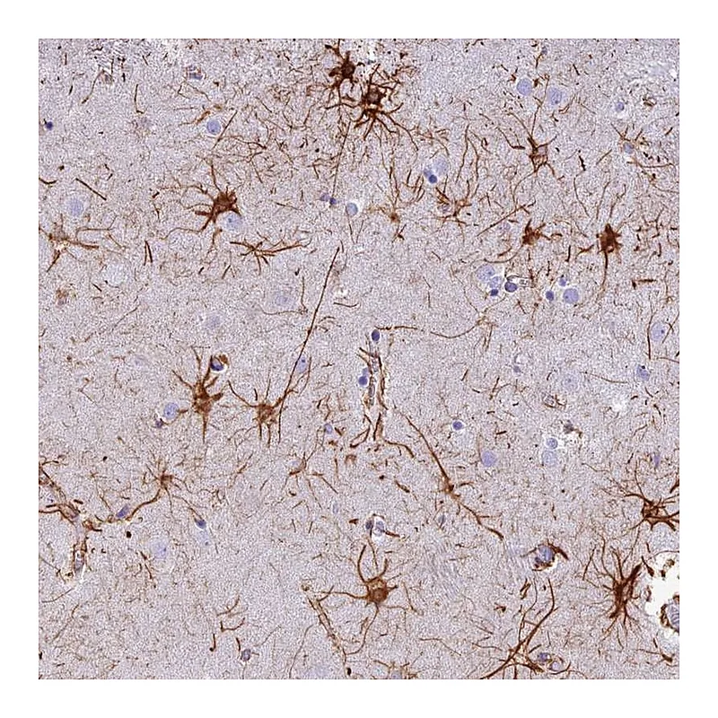 Atlas Antibodies Anti-C17orf67 Antibody