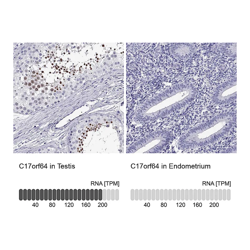 Atlas Antibodies Anti-C17orf64 Antibody