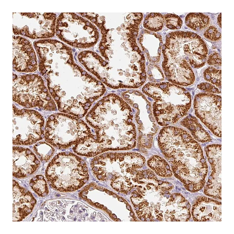 Atlas Antibodies Anti-C17orf98 Antibody