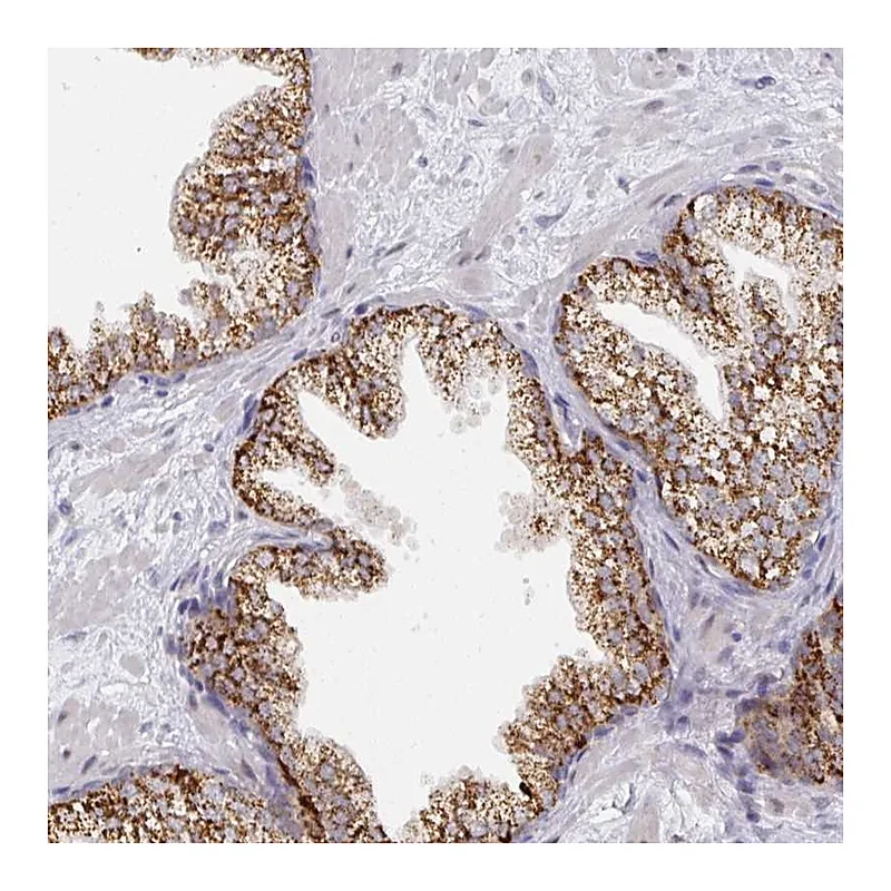 Atlas Antibodies Anti-C18orf25 Antibody