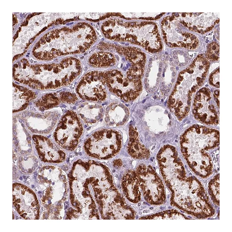Atlas Antibodies Anti-C18orf21 Antibody