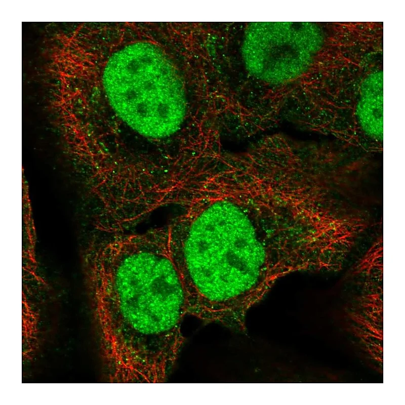 Atlas Antibodies Anti-C18orf25 Antibody