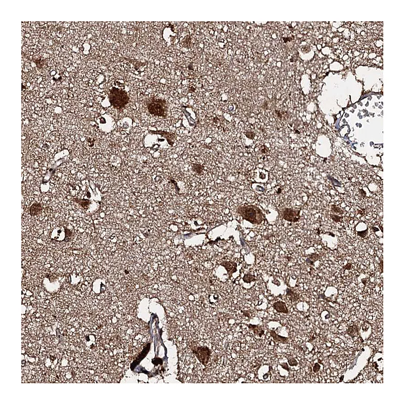 Atlas Antibodies Anti-C18orf32 Antibody
