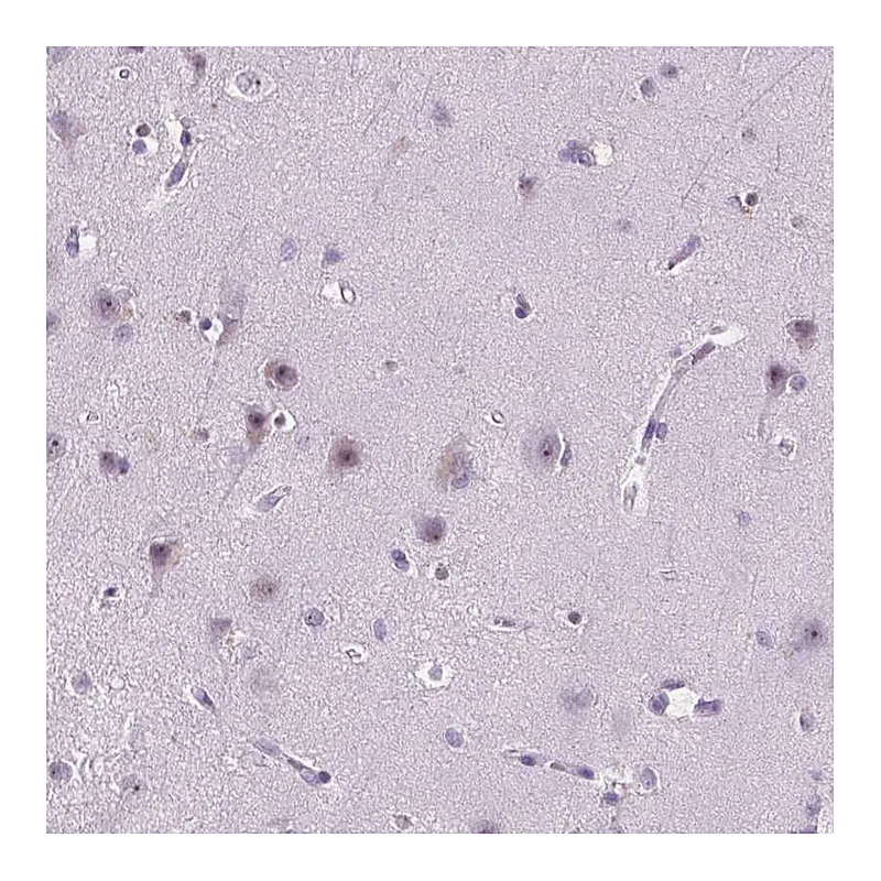 Atlas Antibodies Anti-C18orf21 Antibody