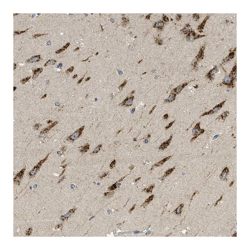 Atlas Antibodies Anti-C19orf18 Antibody