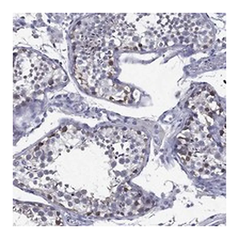 Atlas Antibodies Anti-C19orf18 Antibody