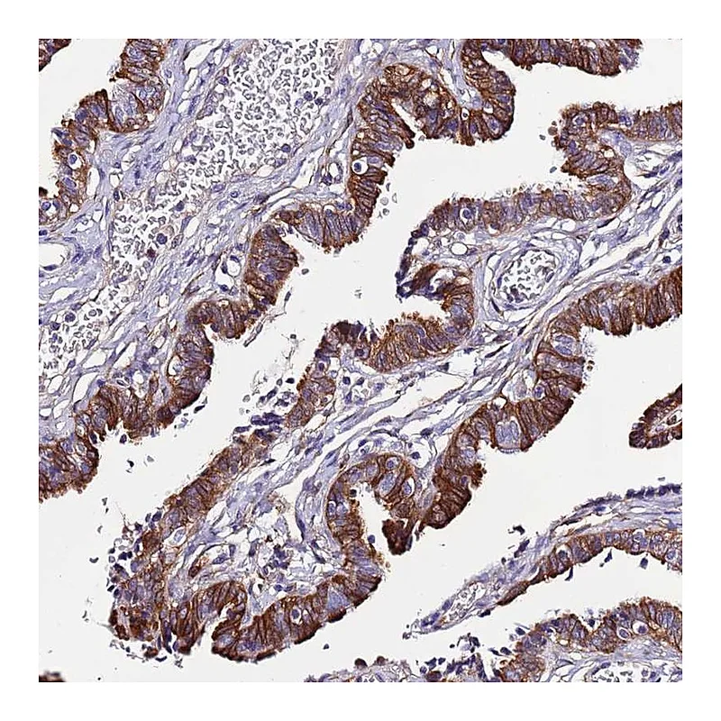 Atlas Antibodies Anti-C19orf24 Antibody