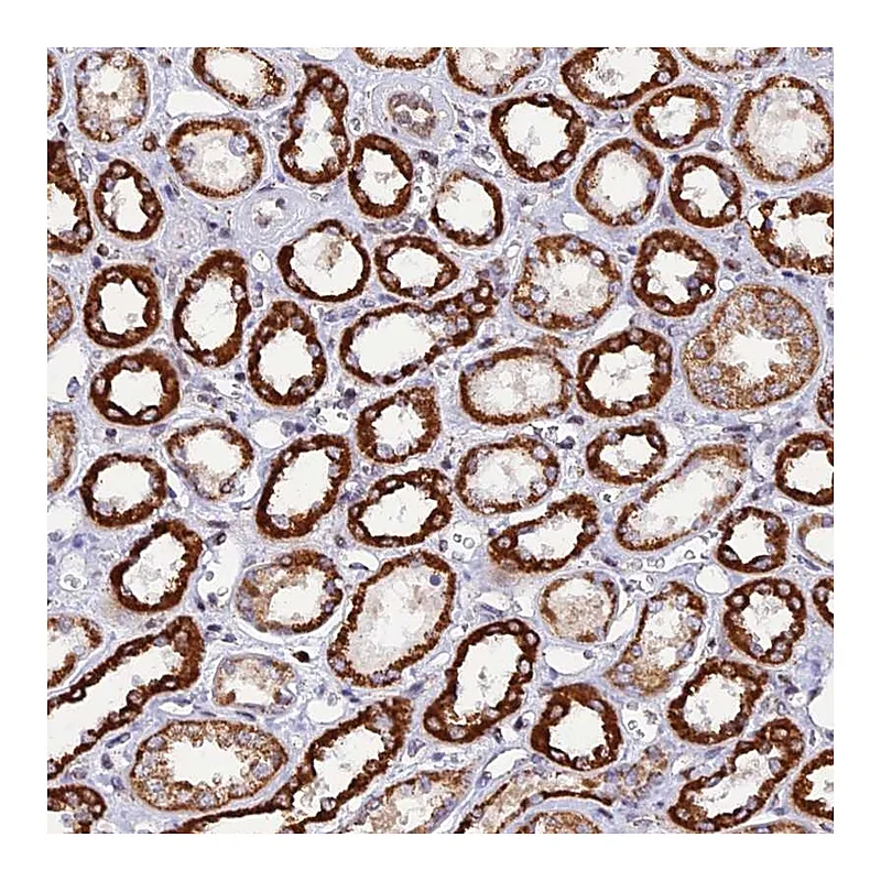 Atlas Antibodies Anti-C19orf24 Antibody