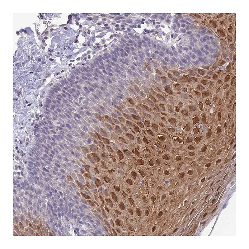 Atlas Antibodies Anti-C19orf25 Antibody