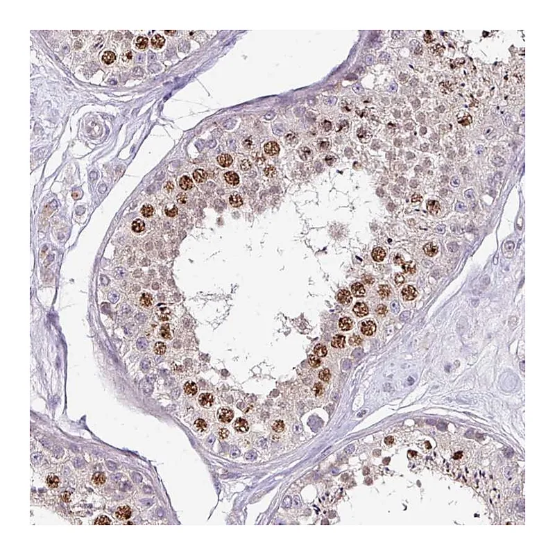 Atlas Antibodies Anti-C19orf33 Antibody