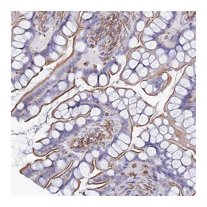 Atlas Antibodies Anti-C18orf8 Antibody