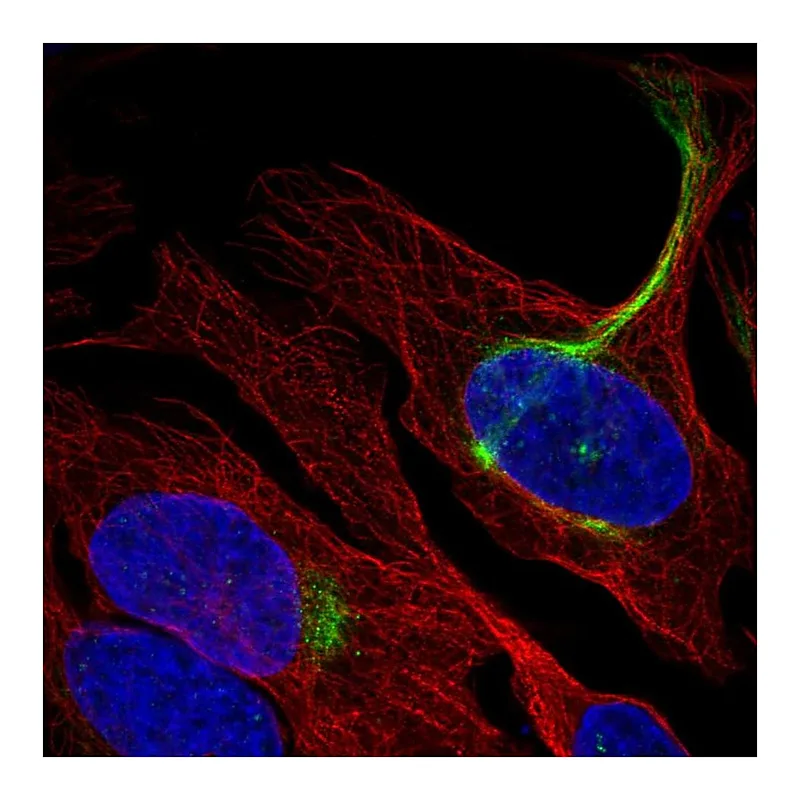 Atlas Antibodies Anti-C19orf25 Antibody