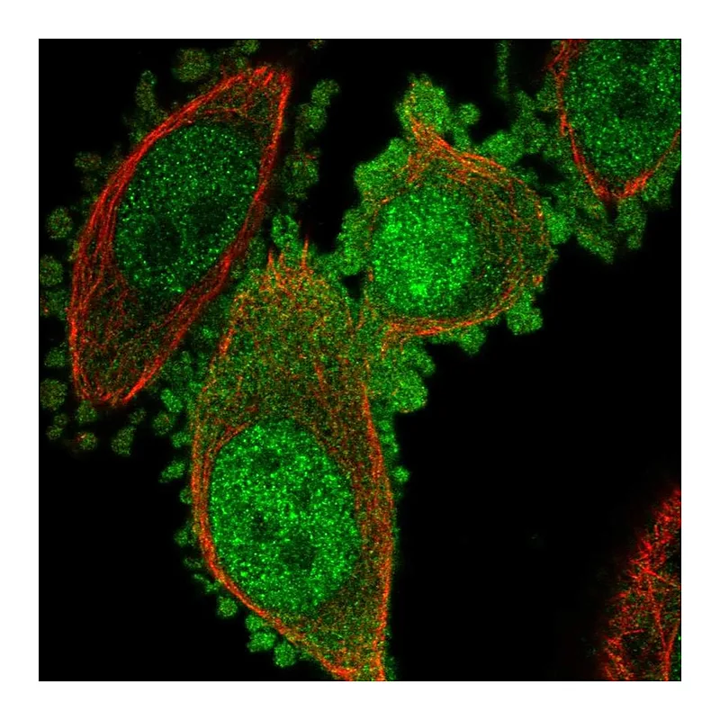 Atlas Antibodies Anti-C19orf33 Antibody