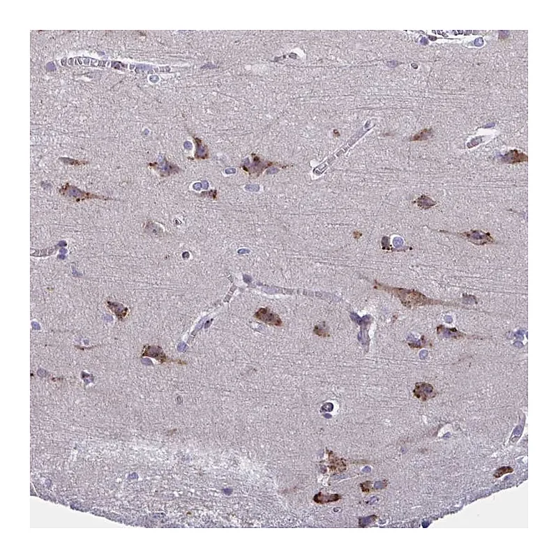 Atlas Antibodies Anti-C19orf35 Antibody