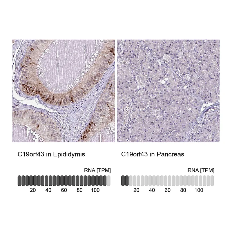 Atlas Antibodies Anti-C19orf43 Antibody