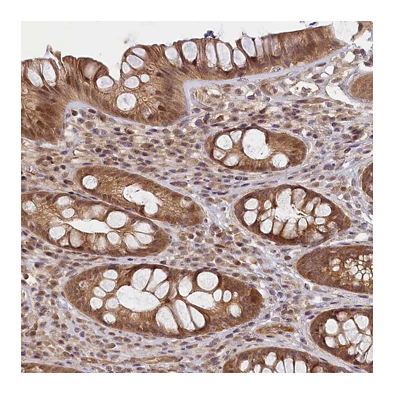 Atlas Antibodies Anti-C19orf44 Antibody