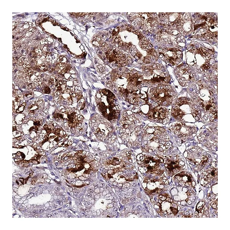 Atlas Antibodies Anti-C19orf47 Antibody