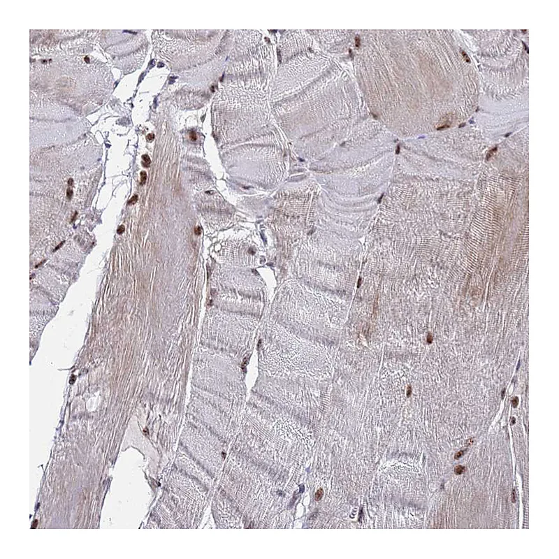 Atlas Antibodies Anti-C19orf47 Antibody