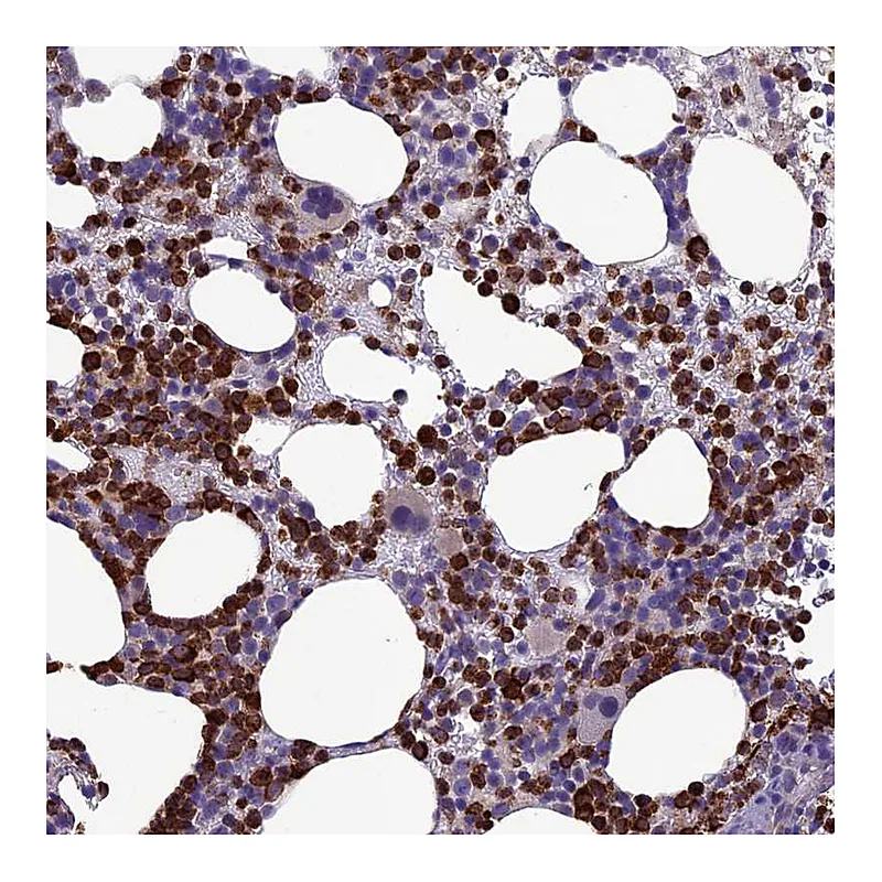 Atlas Antibodies Anti-C19orf48 Antibody