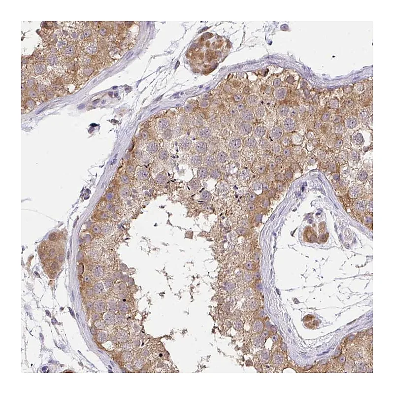 Atlas Antibodies Anti-C19orf54 Antibody