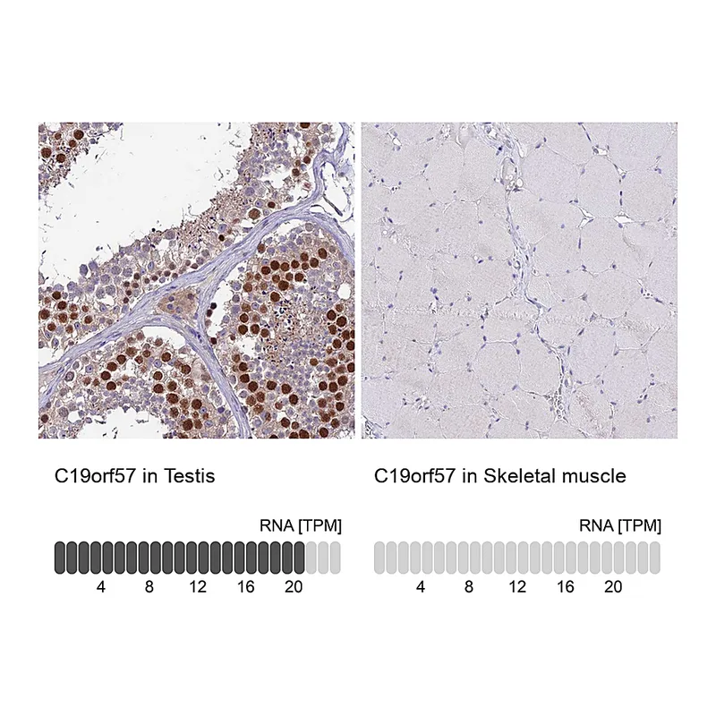 Atlas Antibodies Anti-C19orf57 Antibody